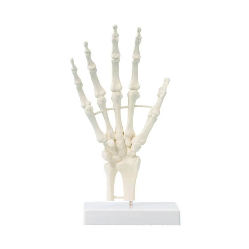 Handskelett mit Strukturen, unbeweglich