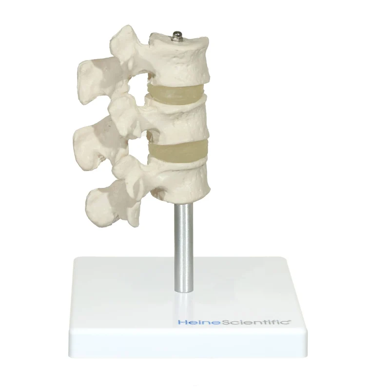 Osteoporose Modell