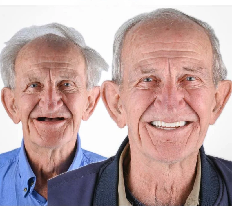 DentalKit - Natürliche Erscheinung und Gefühl ohne Zahnarzt!