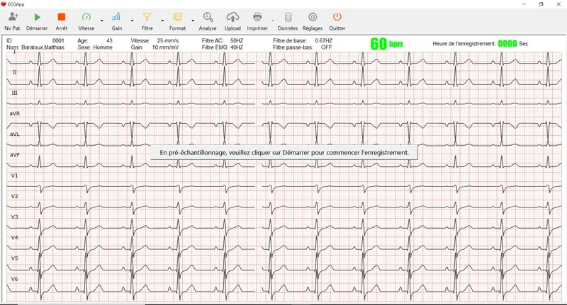 Spengler Cardiomate PC-ECG | 12-kanaals ECG-apparaat