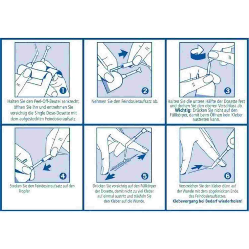 TRUGLUE Haut- und Wundkleber zur Versorgung von Hautläsionen, 10 x Dosette à 0,3 ml - 1 Pack