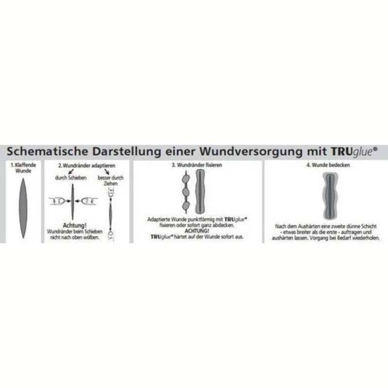 TRUGLUE Haut- und Wundkleber zur Versorgung von Hautläsionen, 10 x Dosette à 0,3 ml - 1 Pack