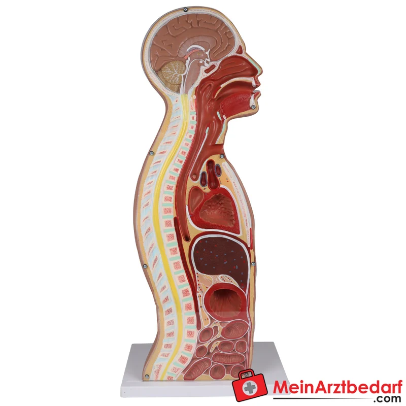 Erler-Zimmer NG Tracheostomie Torso, lebensgroß