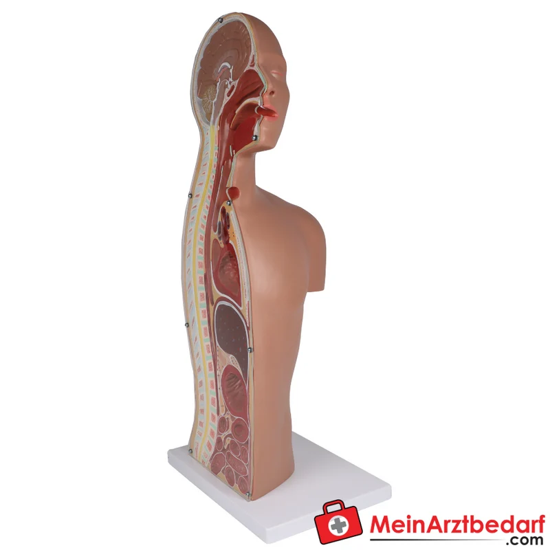 Erler-Zimmer NG Tracheostomie Torso, lebensgroß