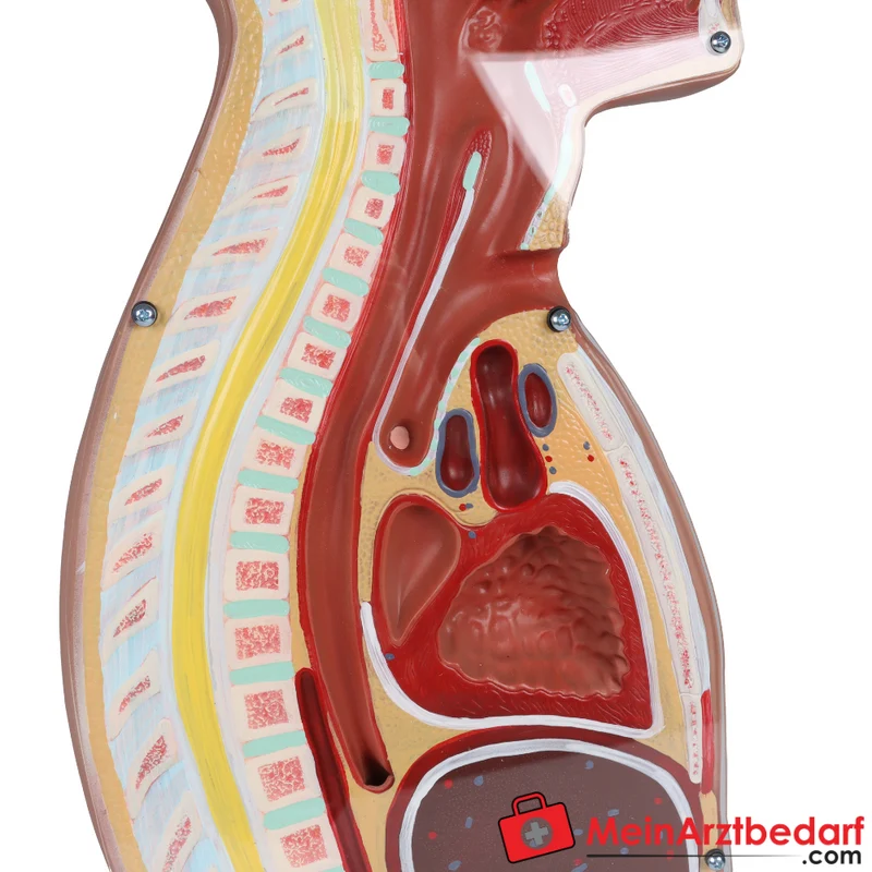 Erler-Zimmer NG Tracheostomie Torso, lebensgroß