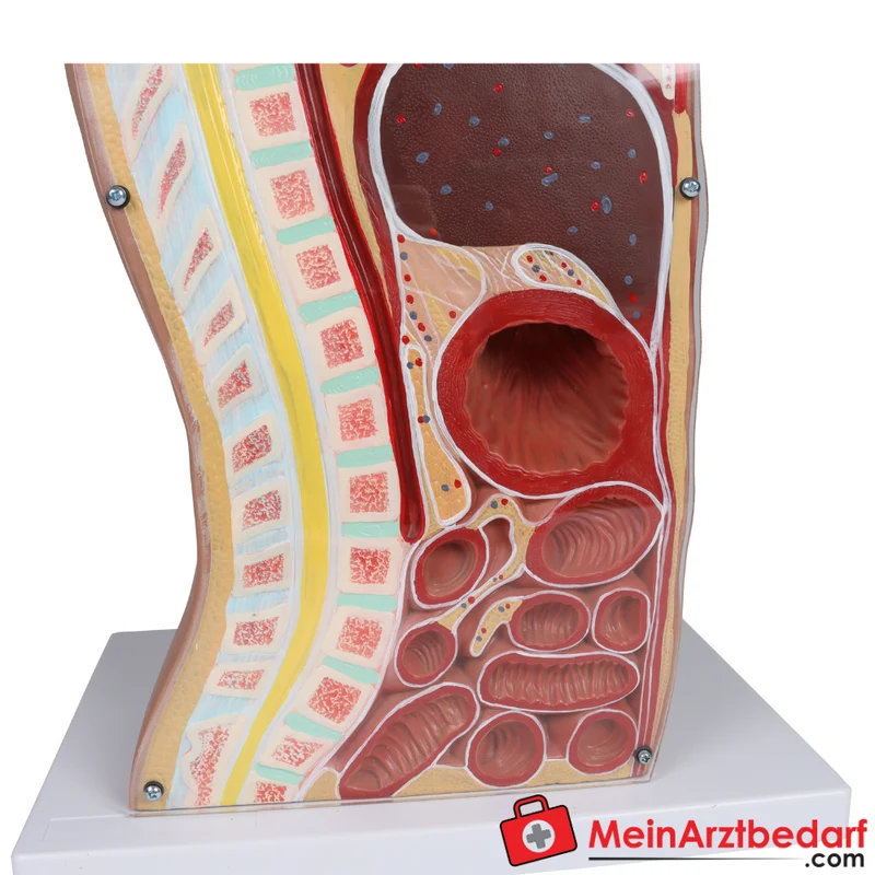 Erler-Zimmer NG Tracheostomie Torso, lebensgroß