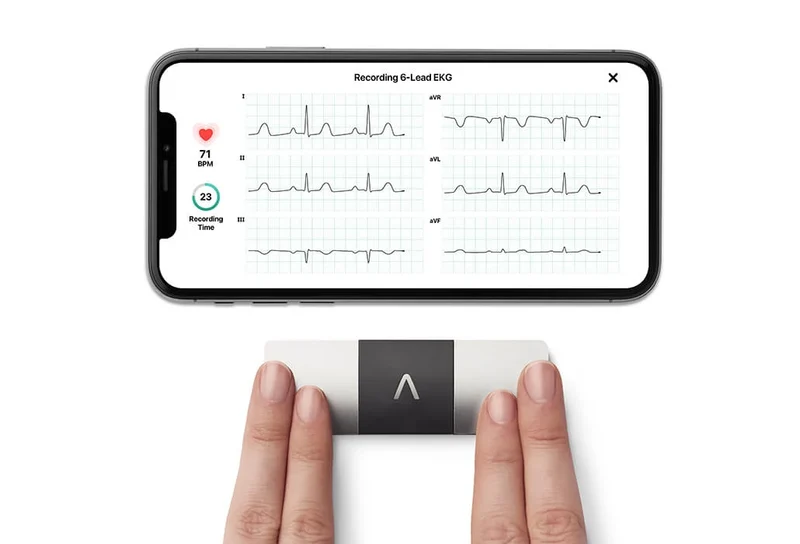 AliveCor Kardia Mobile 6L 6-kanaals ECG apparaat + GRATIS draagtas t.w.v. €24,95