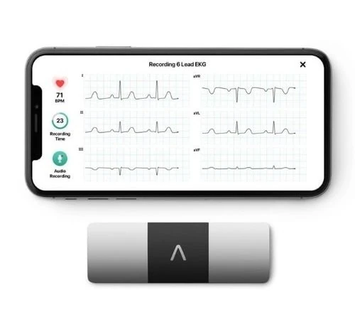 AliveCor Kardia Mobile 6L 6-kanaals ECG apparaat + GRATIS draagtas t.w.v. €24,95