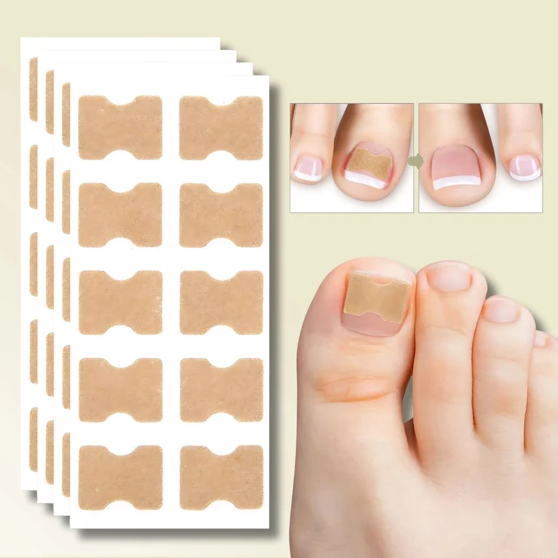 FixaNail | Innovatives Nagelkorrektursystem für gesunde Nägel