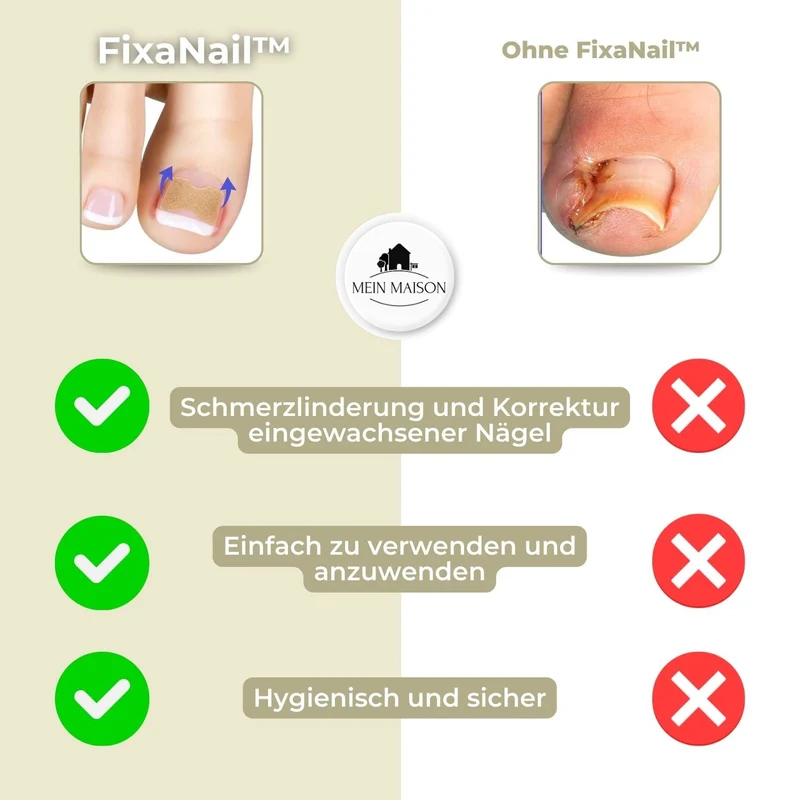 FixaNail | Innovatives Nagelkorrektursystem für gesunde Nägel