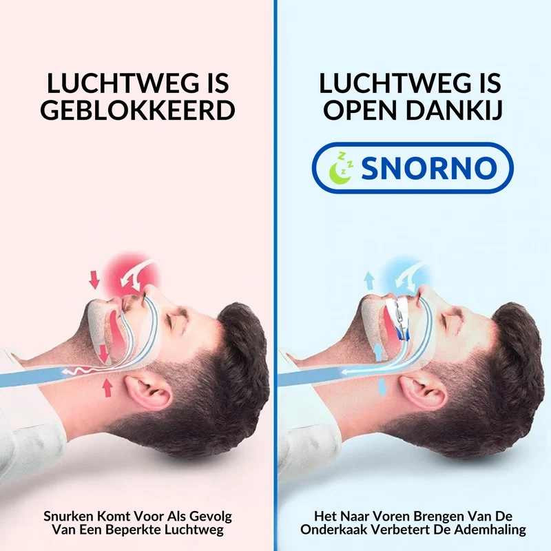 Anti-Schnarch Schiene | Benutzerfreundlich & Premium Komfort