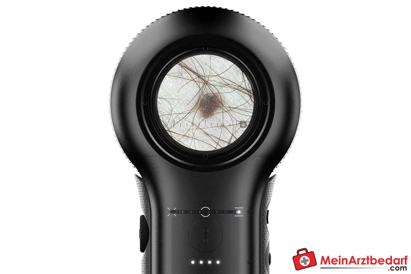 DermLite DL5 Dermatoskop mit variabler Polarisation