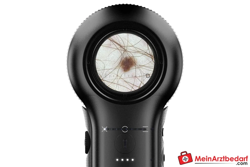 DermLite DL5 Dermatoskop mit variabler Polarisation