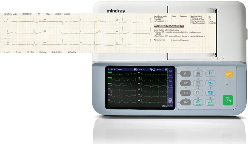 Mindray BeneHeart R3 ECG 12 leads
