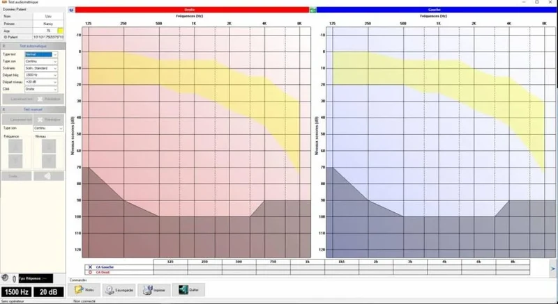 Audiometer 600 M pc-gestuurde audiometer Met standaard hoofdtelefoon