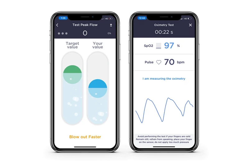 MIR Smart One Oxi spirometer
