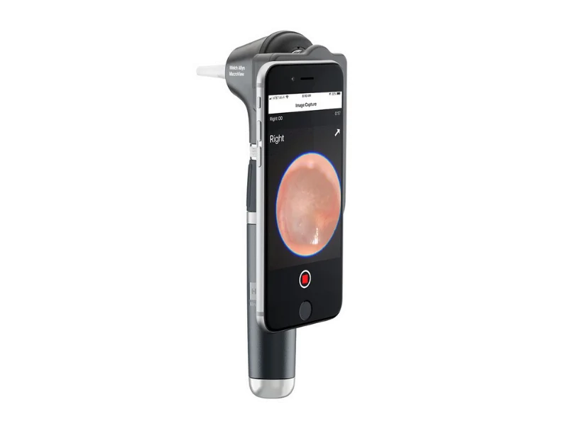Welch Allyn MacroView Plus Oto for iEx