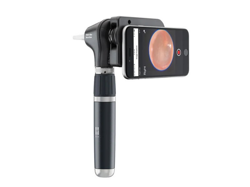 Welch Allyn MacroView Plus Oto for iEx