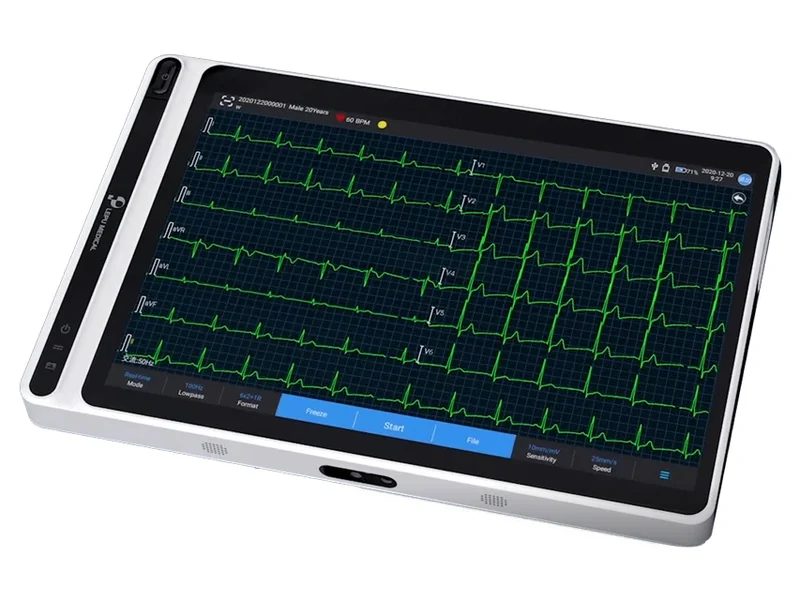 NEO ECG T180 - TABLET-ECG met printer