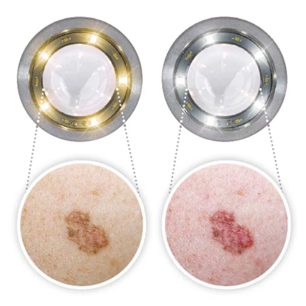 LUXAMED LuxaScope Dermatoskop CCT LED Kopf, Kontaktscheibe OHNE Skalierung