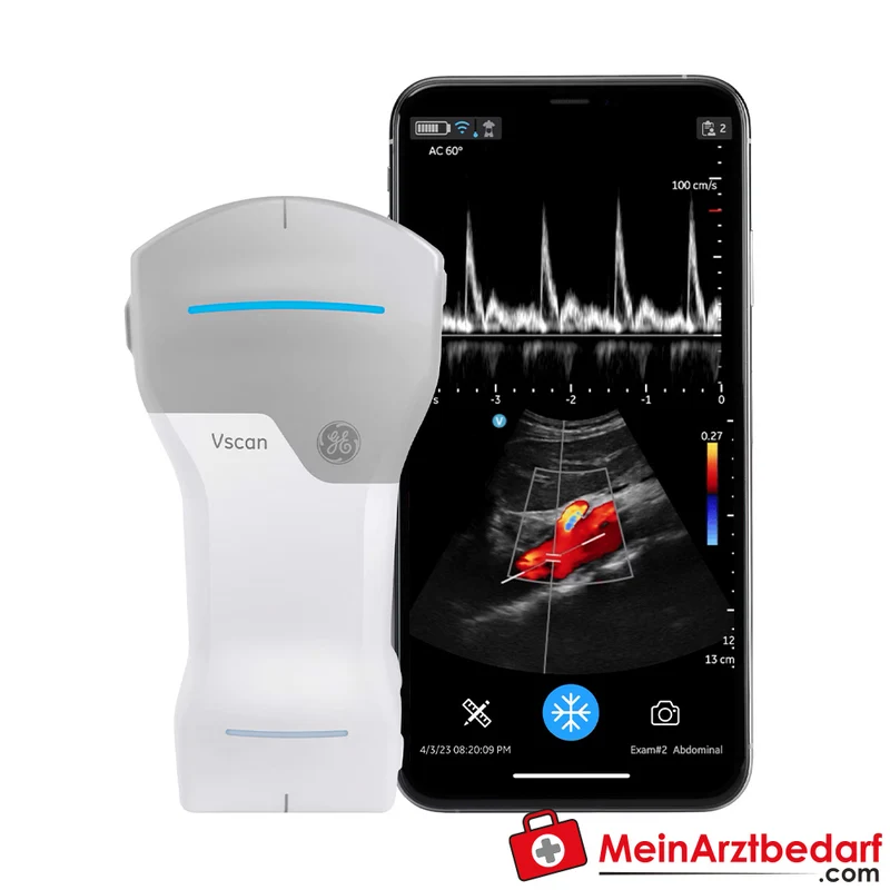 Vscan Air CL Hand-Ultraschallsystem mit Konvex-Linear-Dualsonde