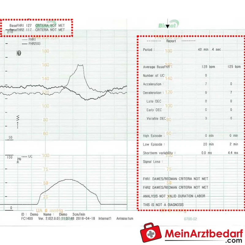 medical ECONET Smart 3 Zwillings-Fetalmonitor