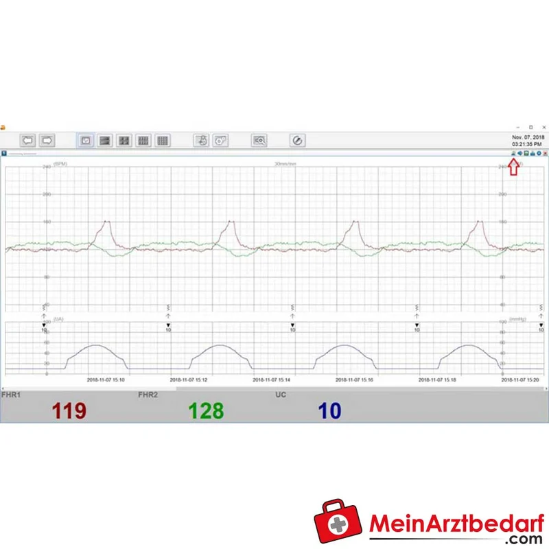 medical ECONET Smart 3 Zwillings-Fetalmonitor