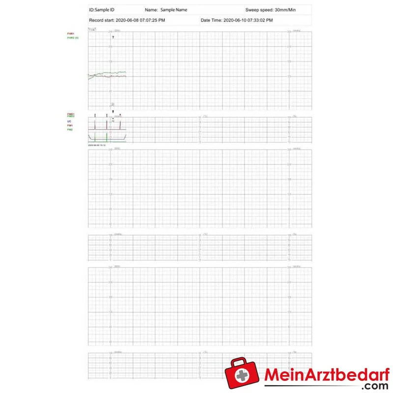medical ECONET Smart 3 Zwillings-Fetalmonitor