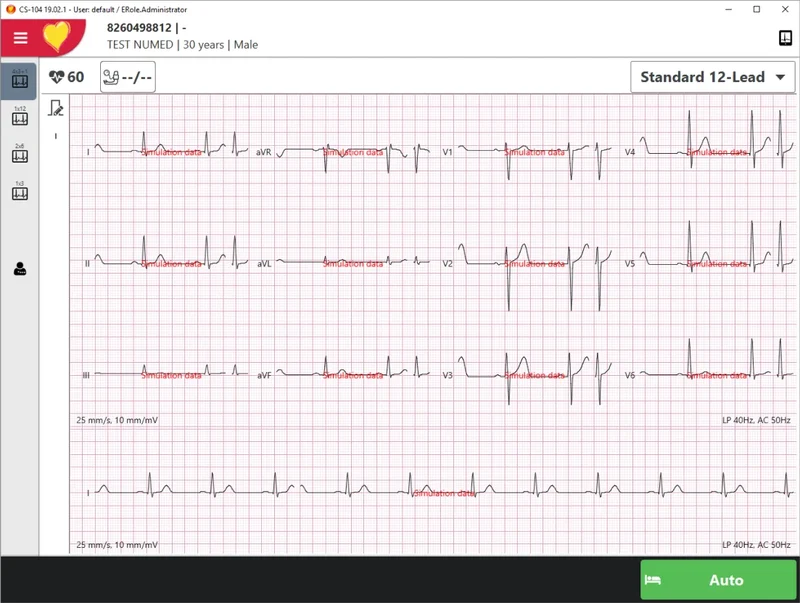 Schiller Cardiovit CS-104 PC-gebaseerd rust-ECG-systeem