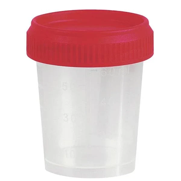 Urinebeker met schroefdeksel - 60 ml - 500 stuks niet-steriel - met witte deksel
