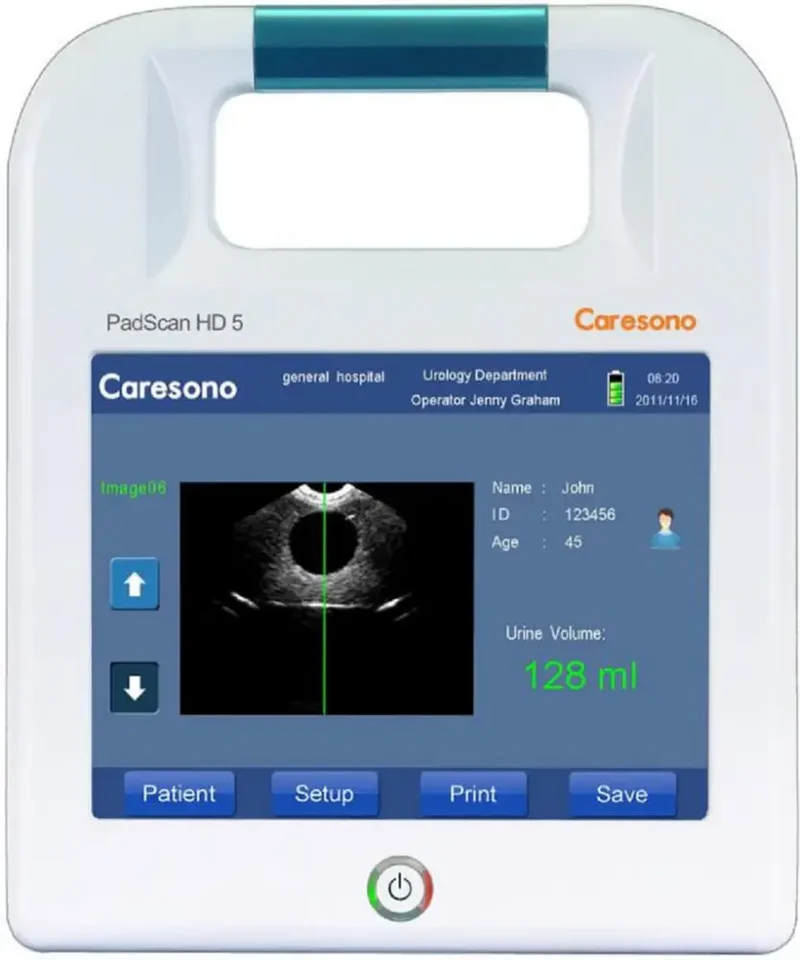 Caresono Bladder Scanner HD5