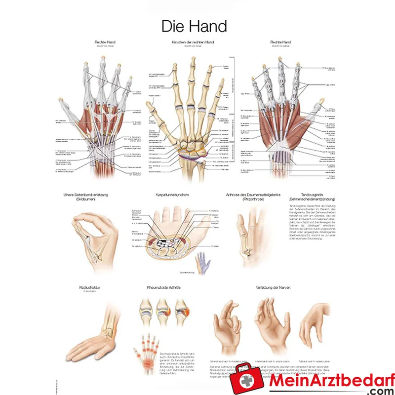 Lehrtafel Die Hand anatomisch 70×100 cm Kunststofffolie mit Metallleisten & 50×70 cm Kunstdruckpapier DE/EN