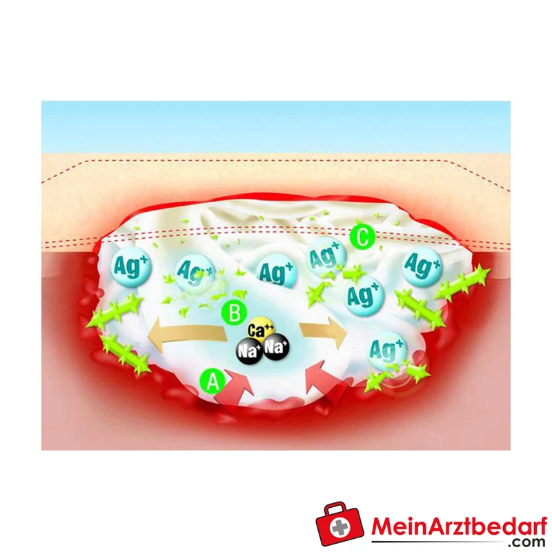Suprasorb A+AG Calciumalginat-Verband antimikrobiell für infizierte und stark exsudierende Wunden