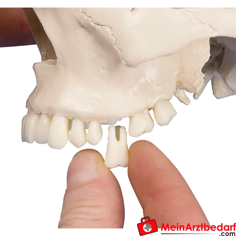 Erler-Zimmer Dental-Schädel 4-teilig – 31 teilbare Zähne, abnehmbarer Unterkiefer, 22 x 13 x 17 cm