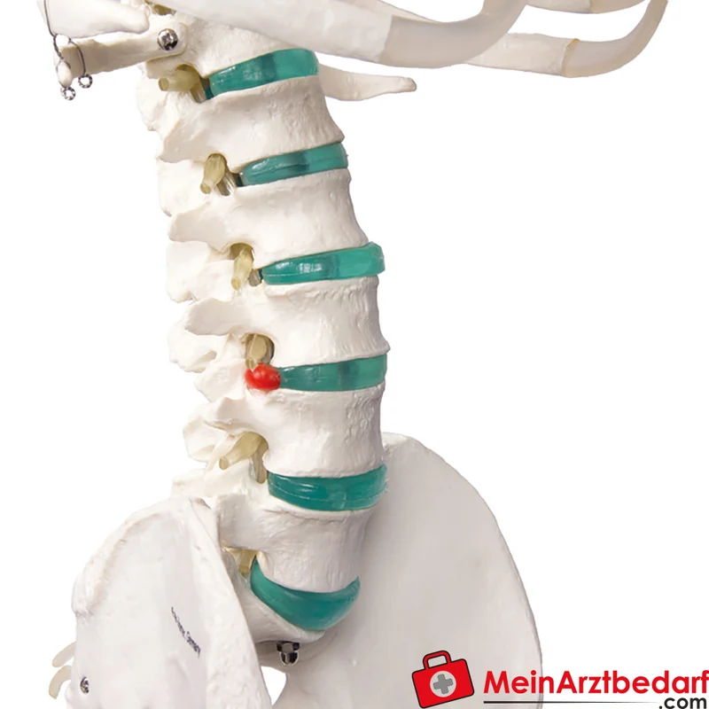 Erler-Zimmer Skelettmodell 178 cm auf fahrbarem Stativ, dreiteiliger Schädel, abnehmbare Arme/Beine, Spinalnerven