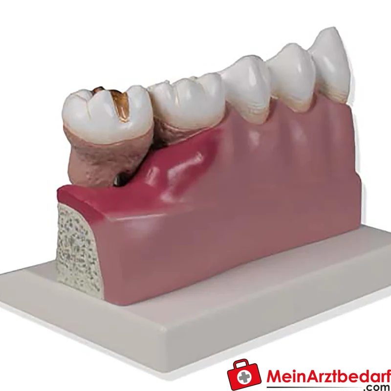 Erler-Zimmer Dentalmodell Unterkiefer 4-fach (Zähne 3–7) EZ Augmented Anatomy mit AR-App