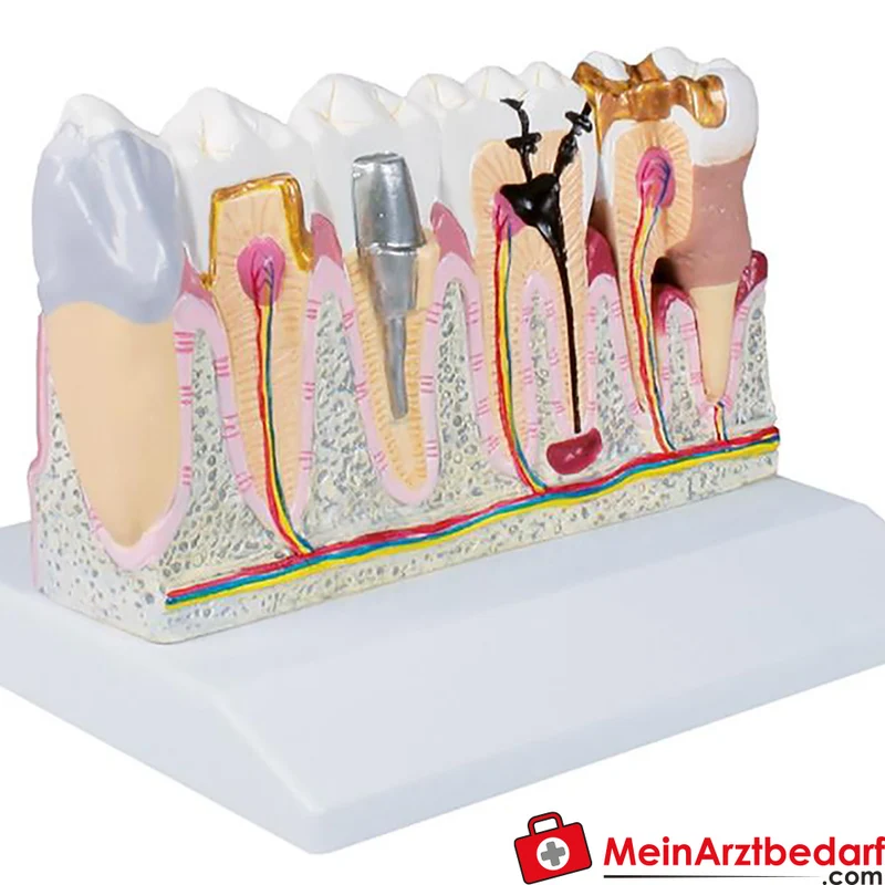 Erler-Zimmer Dentalmodell Unterkiefer 4-fach (Zähne 3–7) EZ Augmented Anatomy mit AR-App