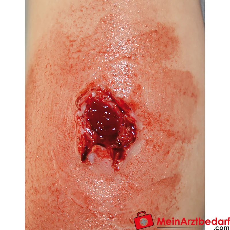 Erler-Zimmer EZ Wounds Wundensimulationsset Professional, 13 Wunden, Trainingsset mit Paste und Kunstblut