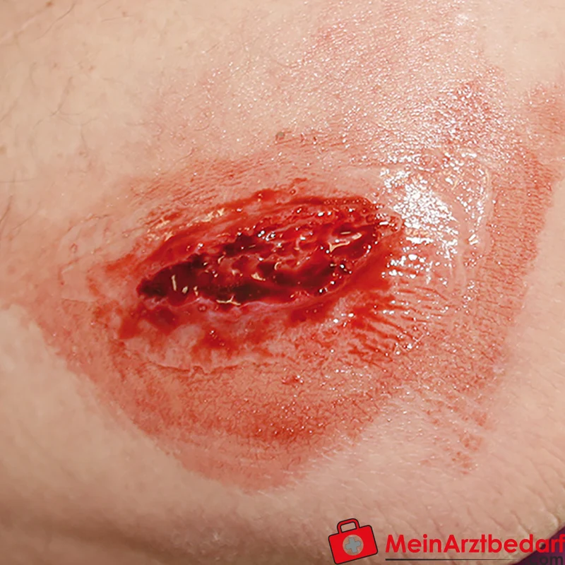 Erler-Zimmer EZ Wounds Wundensimulationsset Professional, 13 Wunden, Trainingsset mit Paste und Kunstblut