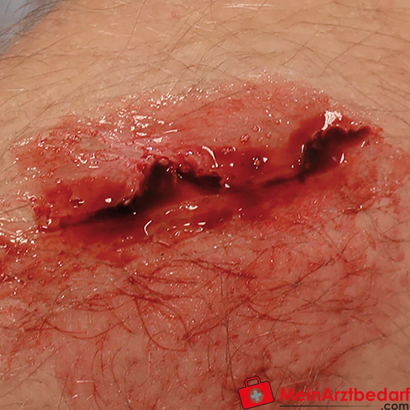 Erler-Zimmer EZ Wounds Wundensimulationsset Professional, 13 Wunden, Trainingsset mit Paste und Kunstblut