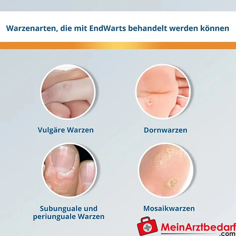 EndWarts FREEZE Vereisungsmittel Distickstoffmonoxid (N2O) 7,5 g