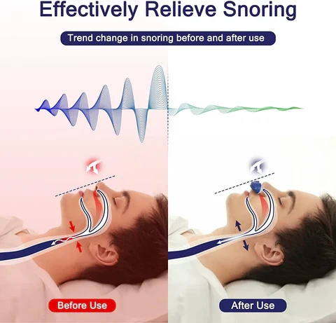 Mikro CPAP-Maske für Reisen & Schnarchen - Medizinisches Silikon
