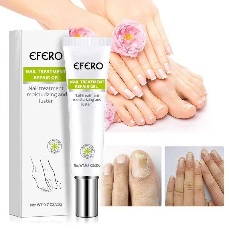 1+1 Gratis | Nagelreparatur | Schnelle und effektive Ergebnisse!