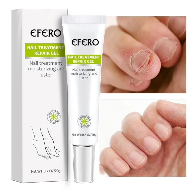 1+1 Gratis | Nagelreparatur | Schnelle und effektive Ergebnisse!