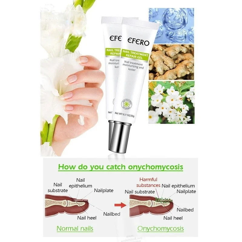 1+1 Gratis | Nagelreparatur | Schnelle und effektive Ergebnisse!
