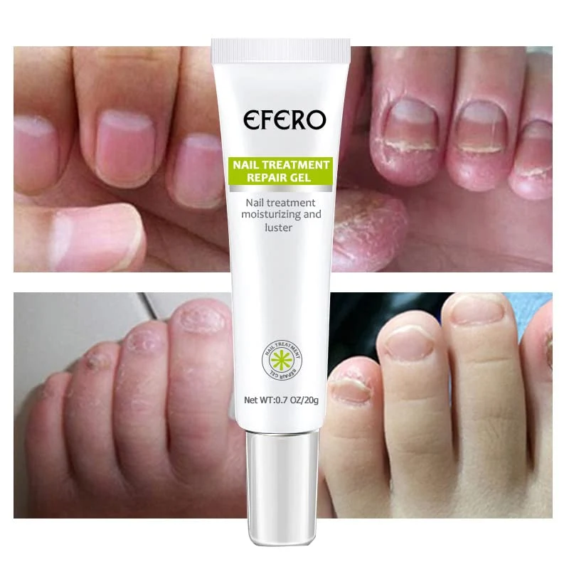 1+1 Gratis | Nagelreparatur | Schnelle und effektive Ergebnisse!