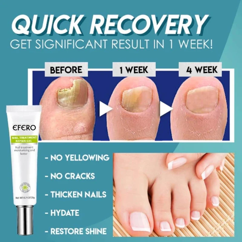 1+1 Gratis | Nagelreparatur | Schnelle und effektive Ergebnisse!