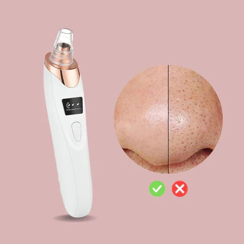 50% Rabatt | PoreGlow™ | Mitesserentferner