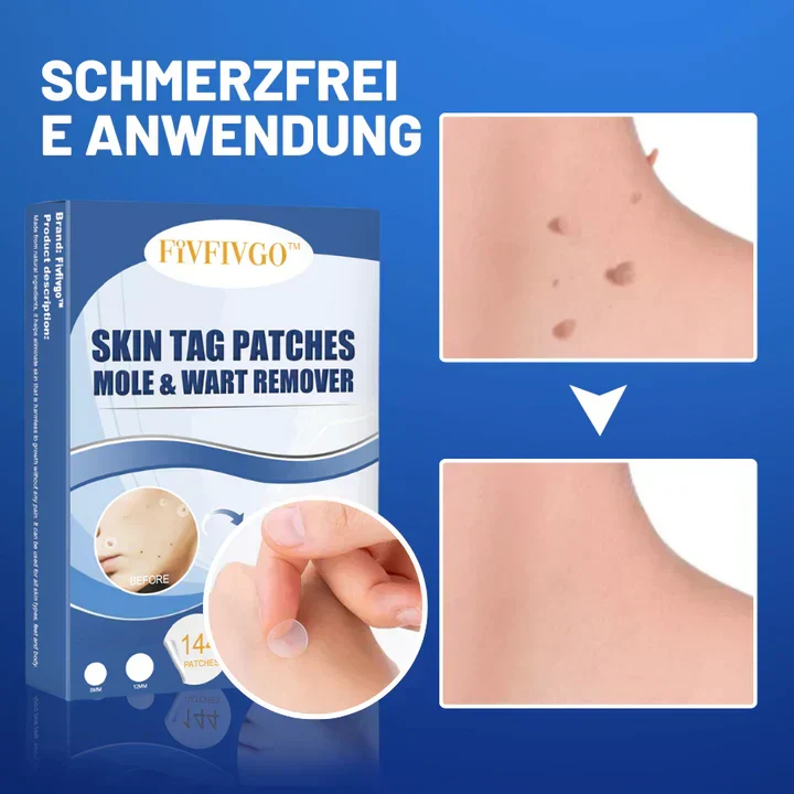 50% Rabatt | TagAway™ | Pflaster zur Entfernung von Hautanhängern und Warzen [Letzter Tag Rabatt]