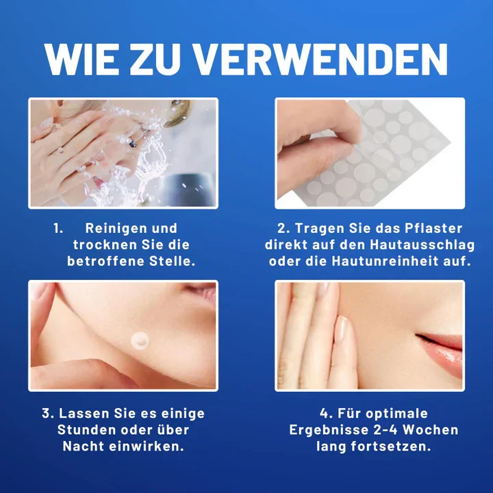 50% Rabatt | TagAway™ | Pflaster zur Entfernung von Hautanhängern und Warzen [Letzter Tag Rabatt]